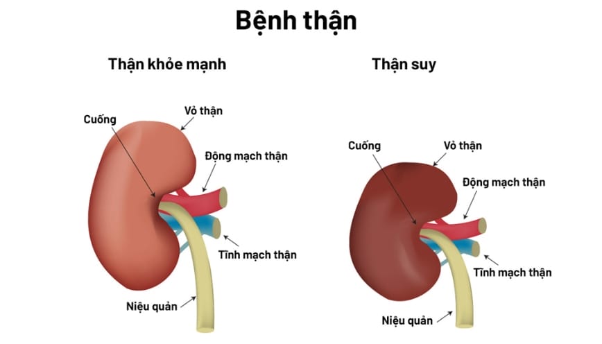 Từ suy được sử dụng nhiều trong các lĩnh vực